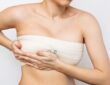 After Breast Lift Surgery
