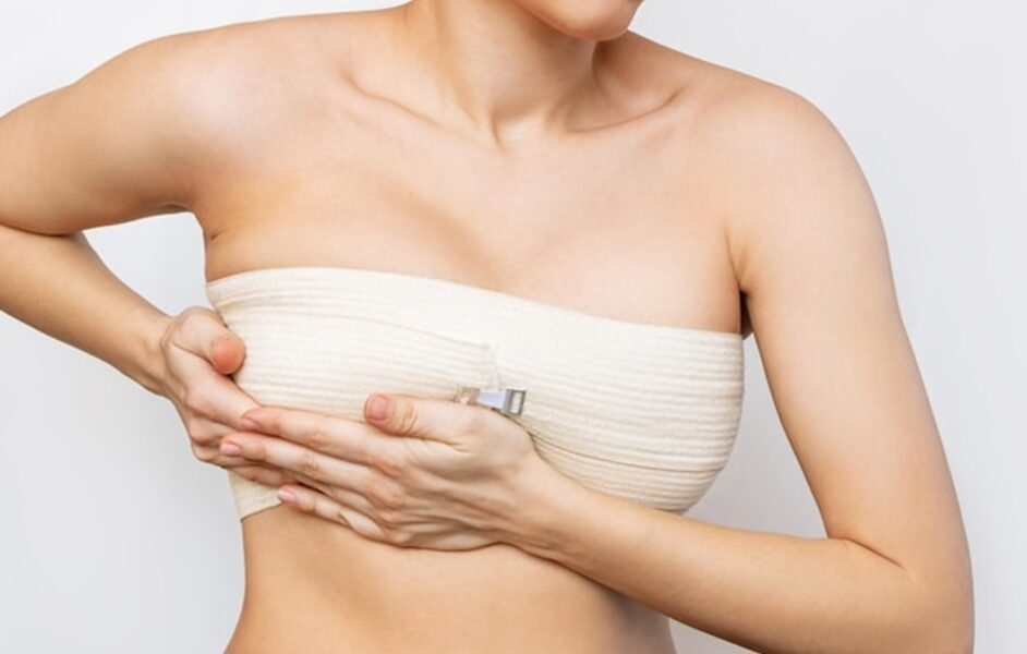 After Breast Lift Surgery