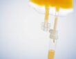 IV Vitamin Therapy